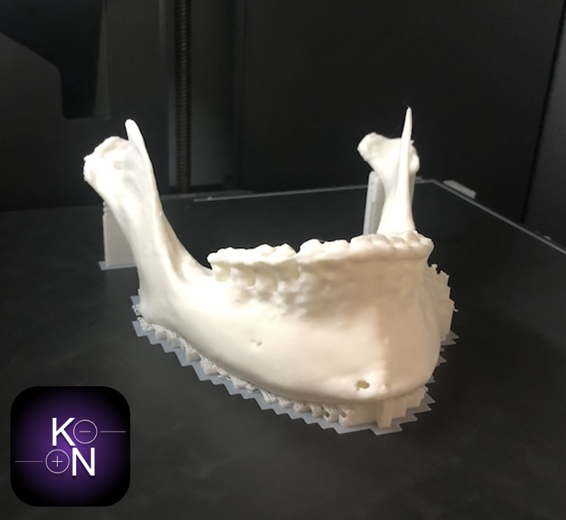 Wydrukowany model 3D szczęki dolnej na drukarce FDM w Cime