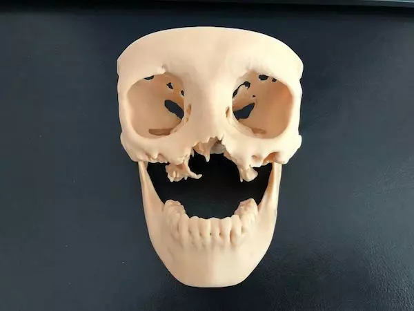 Wydruk 3d czaszki z żuchwą dla implantów indywidualnych